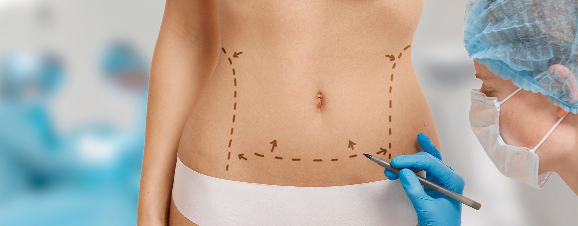 Body surgery including liposuction