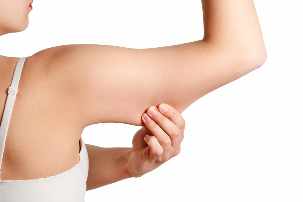 Woman pinching excess fat on underarm