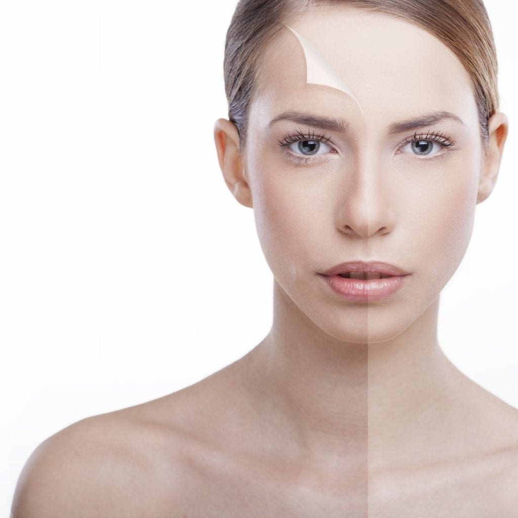 Skin Before and After non-surgical treatment