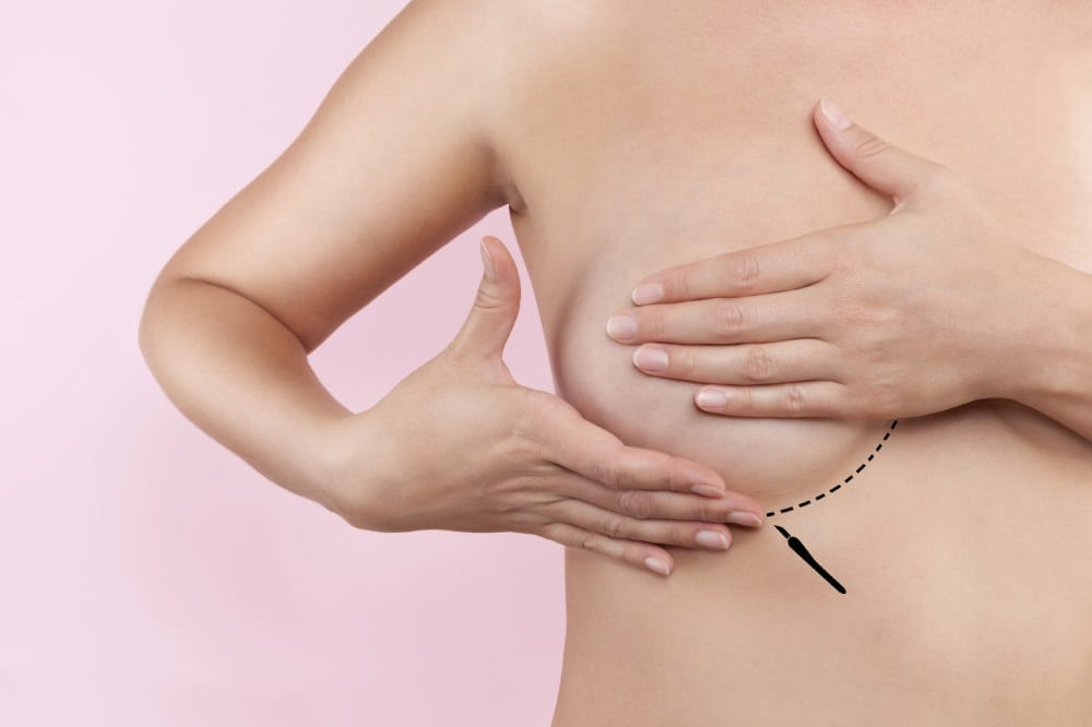 breast reduction surgery at askin clinic