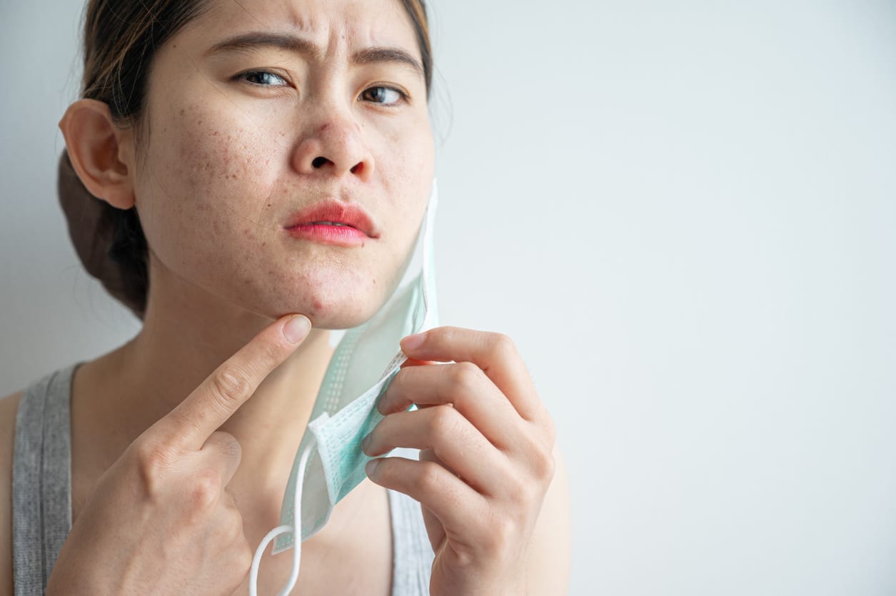 Wearing mask for prolonged periods can damage the skin