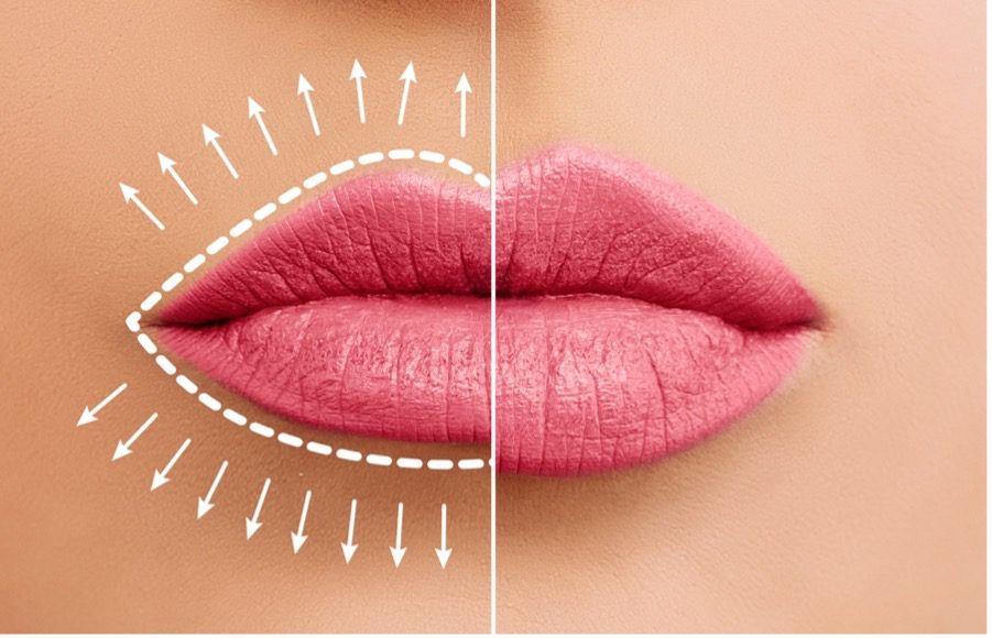 A close-up of a person's lips