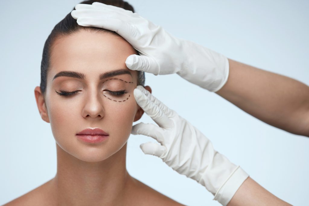 Woman preparing for eyelid surgery