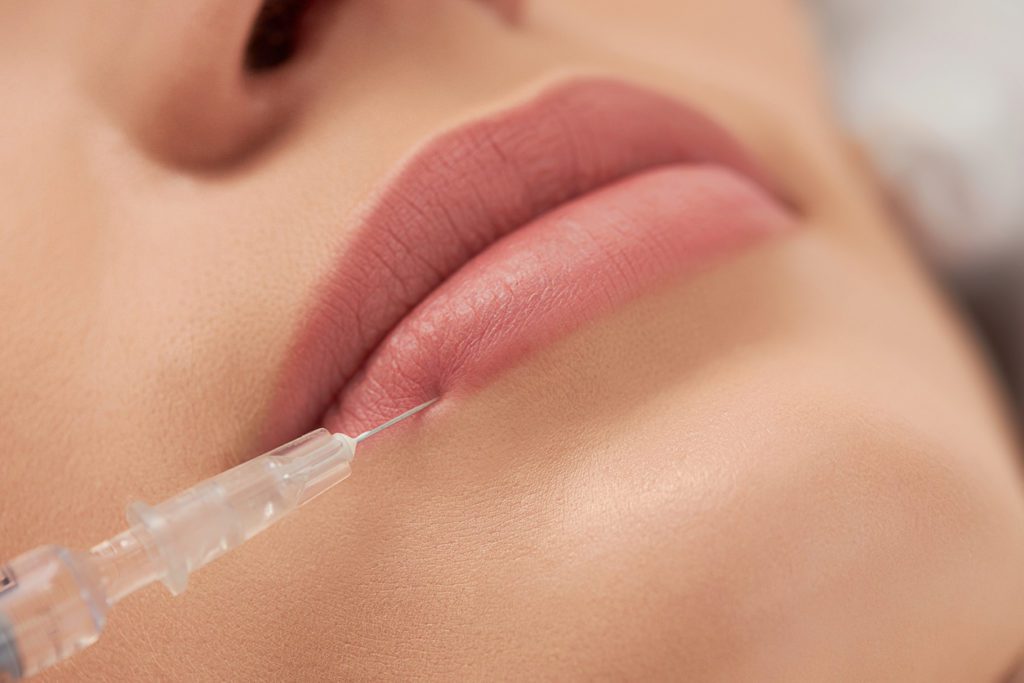 Close up image of a woman having lip fillers