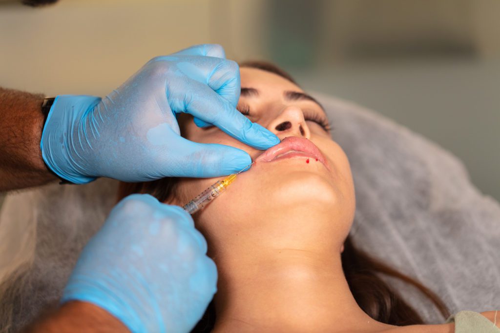 A woman having lip fillers