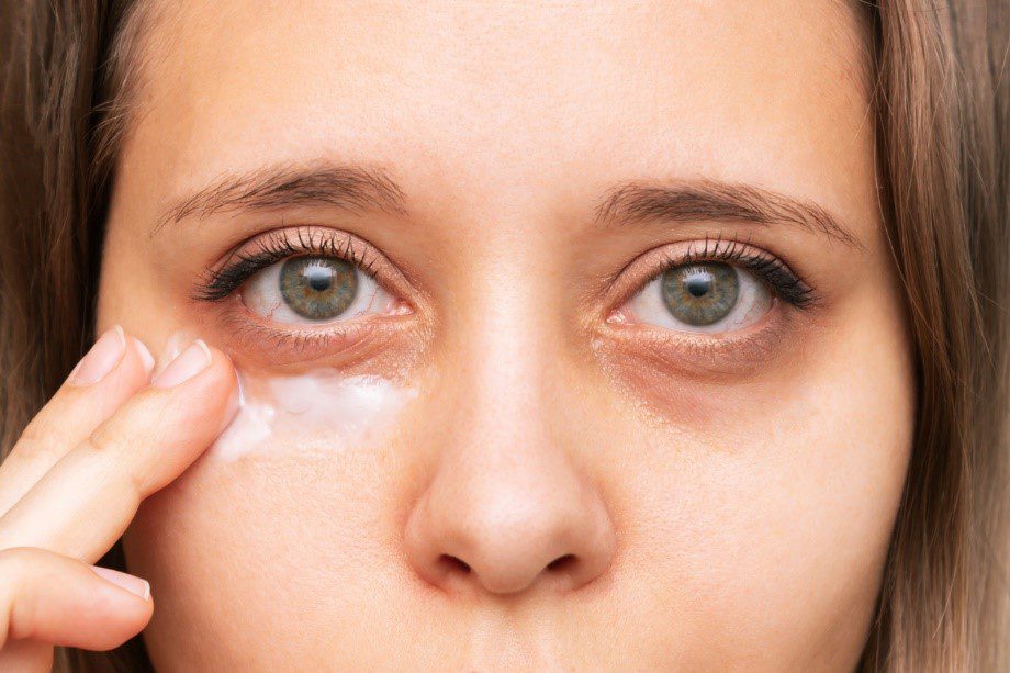 Woman putting moisturiser on eye bags