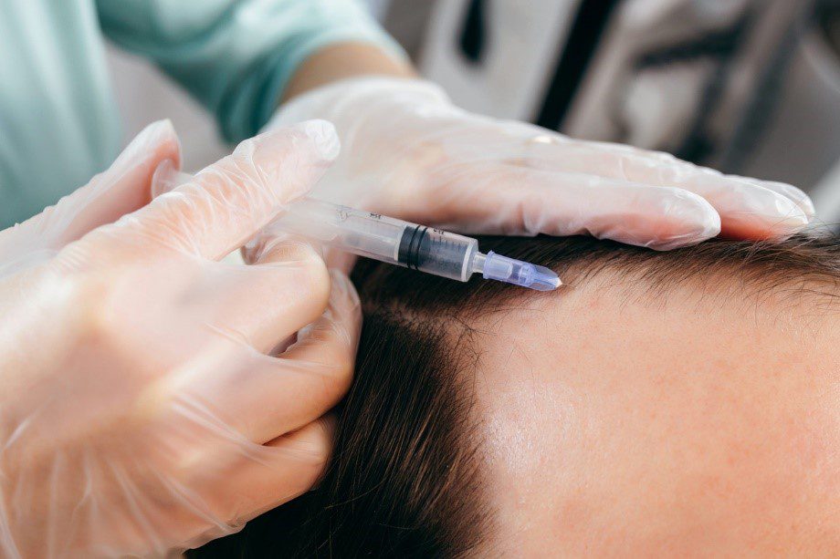 injecting hair loss treatment