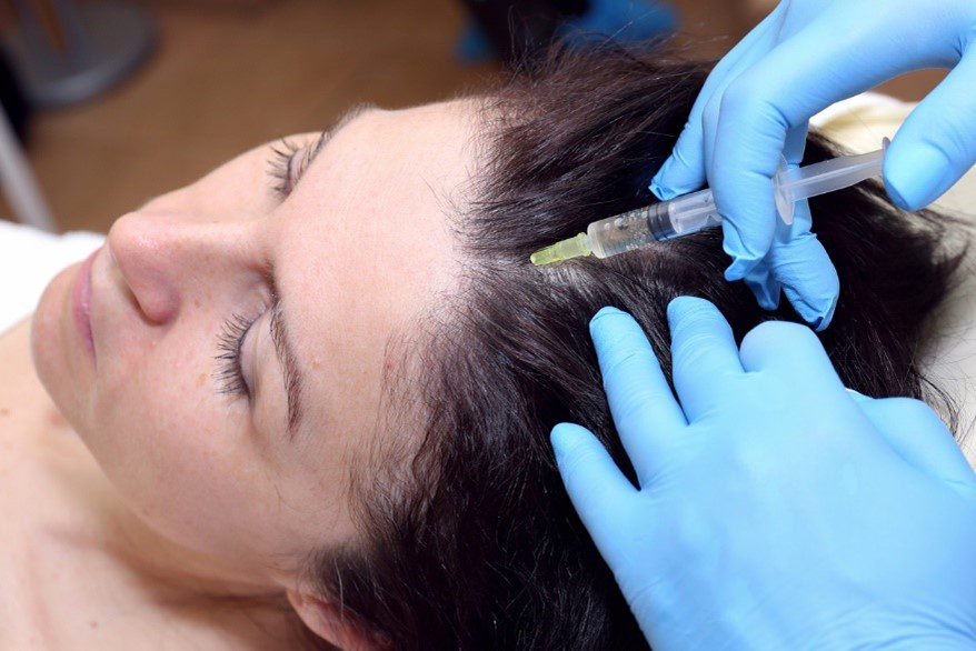 woman having hair loss injections
